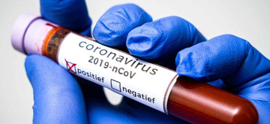 коронавирус,коронавирус пробирка,анализ на covid-19