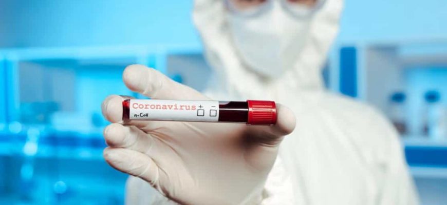 тест на коронавирус,тест на коронавирусную инфекцию,коронавирус,коронавирусная инфекция,covid-19,